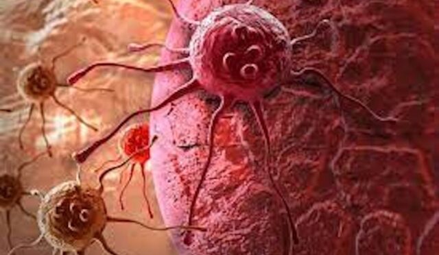 Kanser hücrelerini ortadan kaldırıyor.