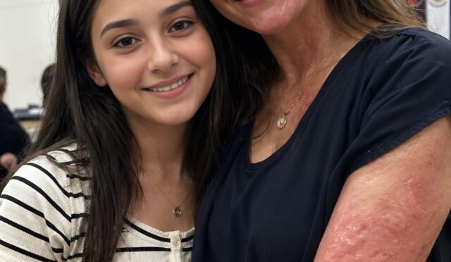 Görünüşümdeki izler yüzünden çevredekilerin kızıma ve bana yönelik rencide edici tavırlarıyla savaşıyorduk.